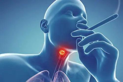 喉癌復發轉移的預防與治療