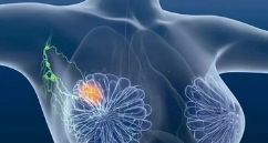 乳腺癌出現骨轉移藥物治療方案